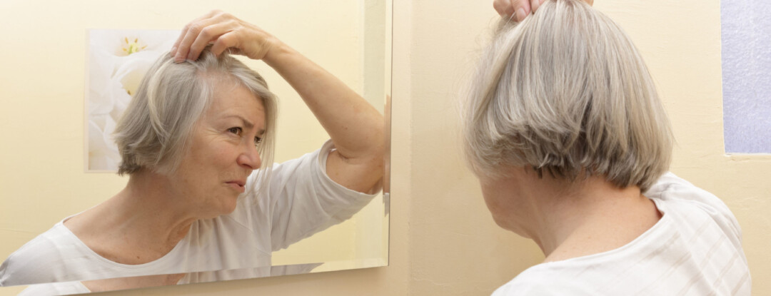 4 adviezen tegen haarverlies