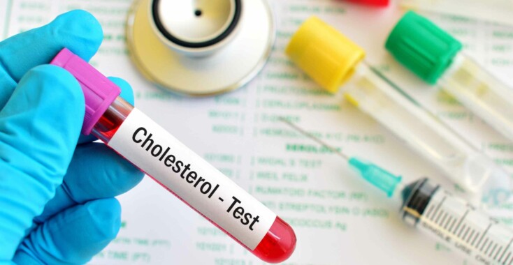 Hoog cholesterol?